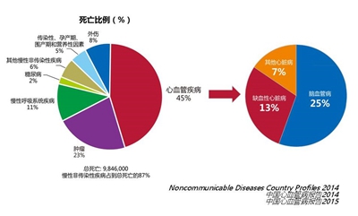 进展性脑卒中严重吗_进展脑严重性卒中的症状_进展脑严重性卒中的原因