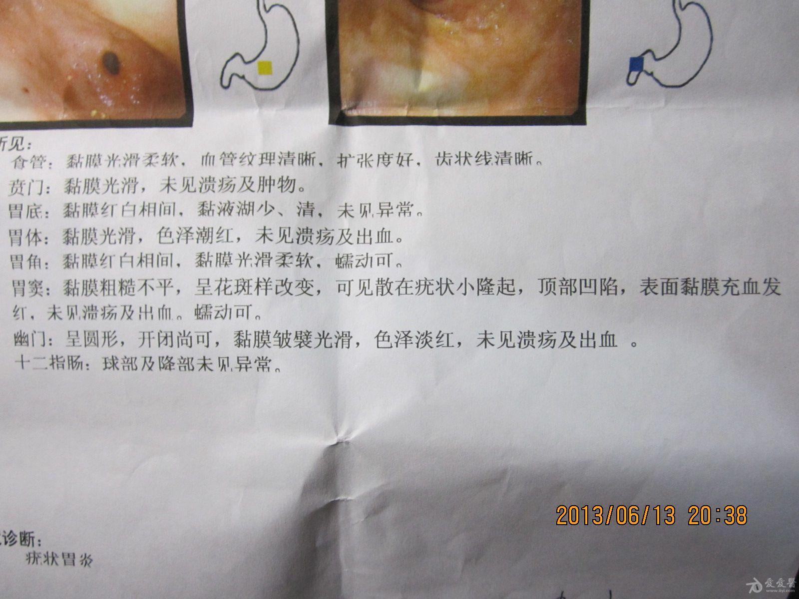 根治胃病论坛_胃病治愈论坛_彻底根治所有胃病奇方