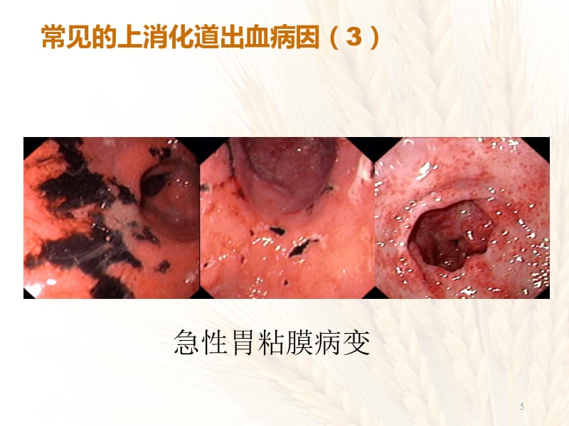 拉屎拉出血来_出血拉屎出血_出血拉屎拉来就没有了