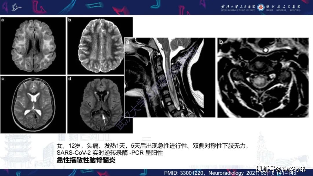 维生素b1缺乏神经病_神经缺乏维生素的症状_缺乏神经维生素病变的症状