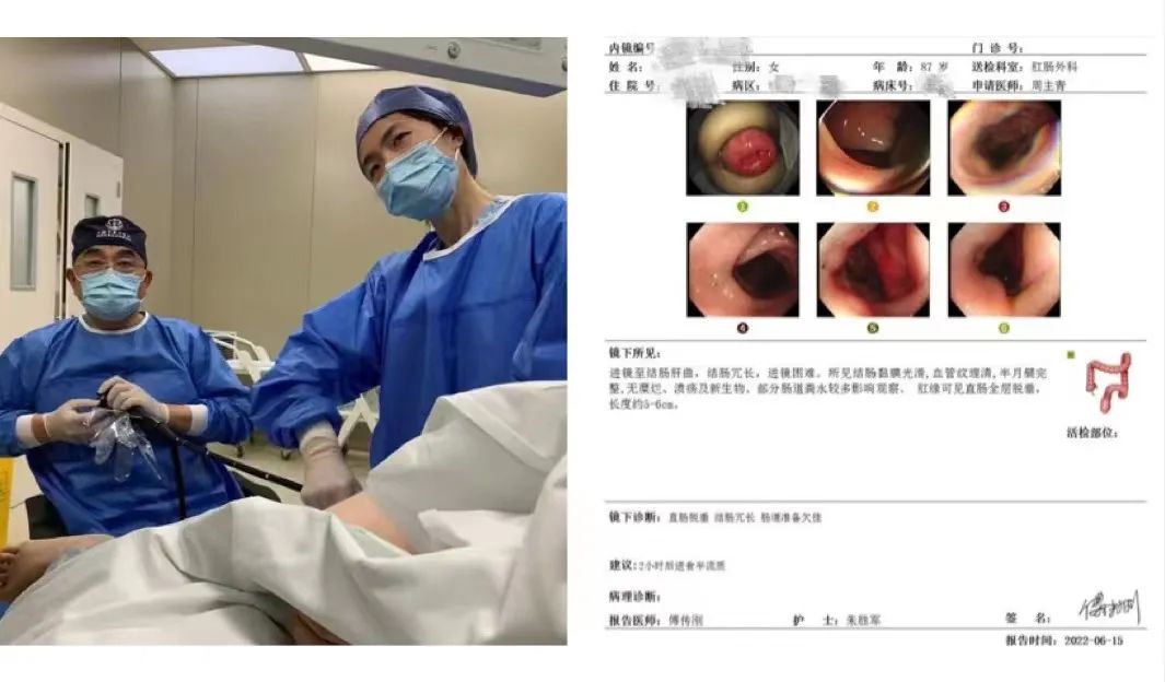 肛脱垂了怎么办_肛肠脱垂肛门失禁_肛门垂脱需要手术吗