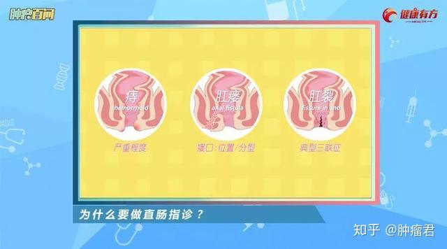 肛裂肛瘘手术治疗需要多长时间_肛裂肛瘘术后恢复过程_肛裂加肛瘘手术