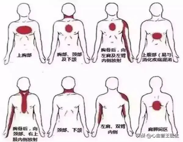 胸前后背有红痣代表什么_后背疼前胸红痣有点疼_前胸后背疼有红痣