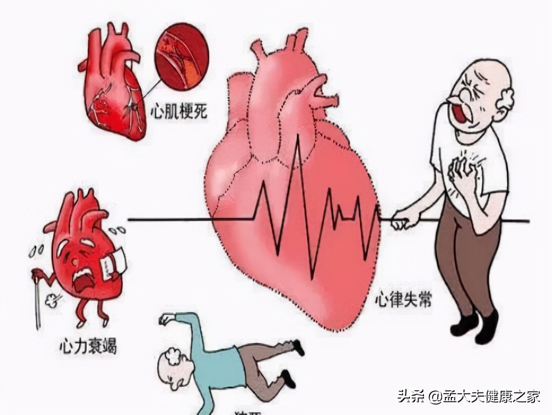 冠心病护理问题及相关因素_护理病人冠心病问题及措施_冠心病病人的护理问题