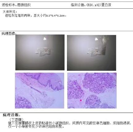 出血大便回事是痔疮吗_大便出血是怎么回事_出血后大便什么病