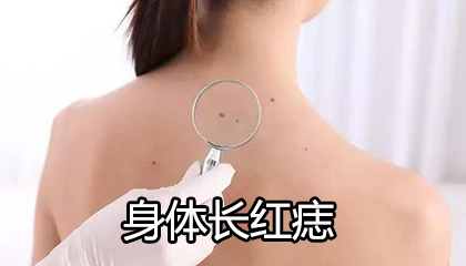 前胸后背疼有红痣_后背疼前胸红痣有点痒_后背疼前胸红痣有点疼