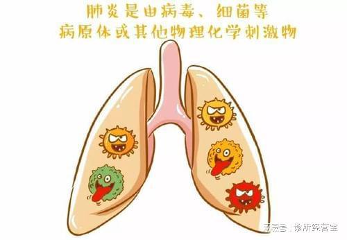 呼吸道合胞病毒性肺炎治疗原则_呼吸合胞病毒性肺炎_呼吸道合胞病毒(rsv)肺炎