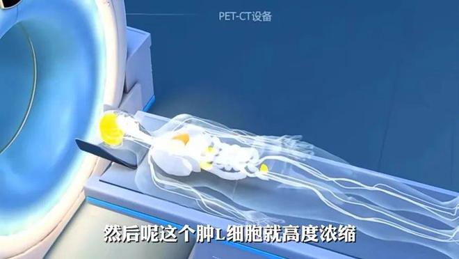 朝阳医院放疗科怎么样_朝阳医院放射科_朝阳医院放射科