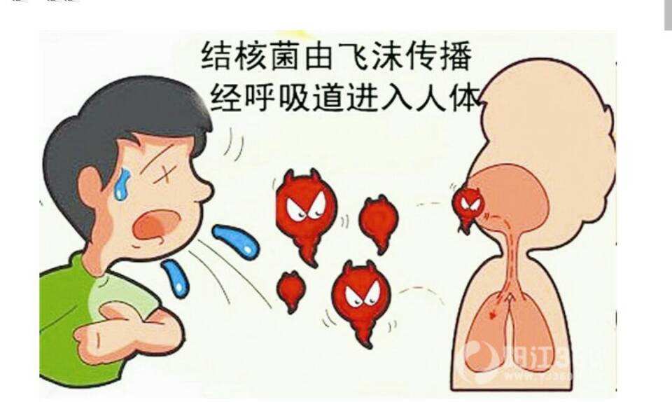 有肺结核的人死后会有传染性吗_肺结核严重吗会死人吗_肺结核死人会传染吗