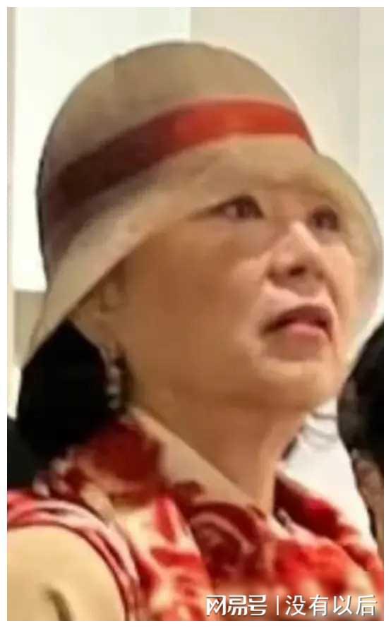 瘦脸针对比图真人_瘦脸针对比照_打botox瘦脸效果图对比