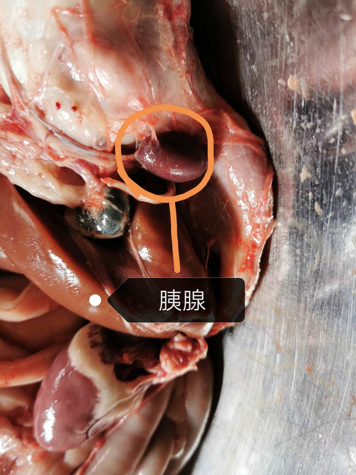急性盲肠炎鸭子盲肠炎解剖图片_急性盲肠炎吃什么药好_急性盲肠炎怎么缓解