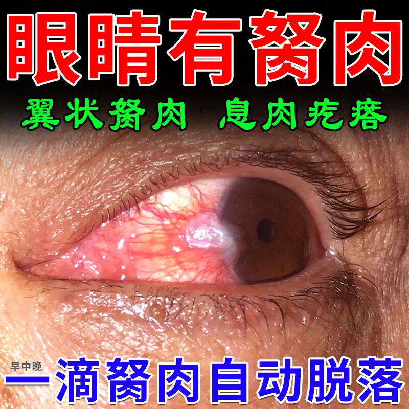 北京朝阳眼科医院地址在哪_北京朝阳医院眼科_北京朝阳眼科怎么样