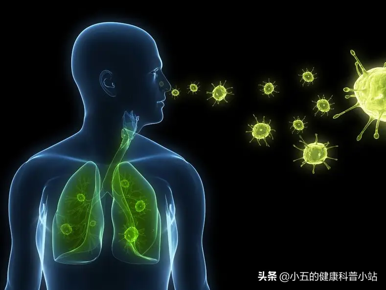 肺部感染的证状_肺部感染的症状_肺部感染征象