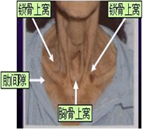 二型呼吸衰竭呼吸频率_呼吸衰竭指数的意义_呼吸衰竭呼吸频率