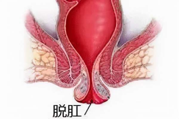 男友插肛门 大便失禁_大便失禁肛门疼_大便失禁肛门袋