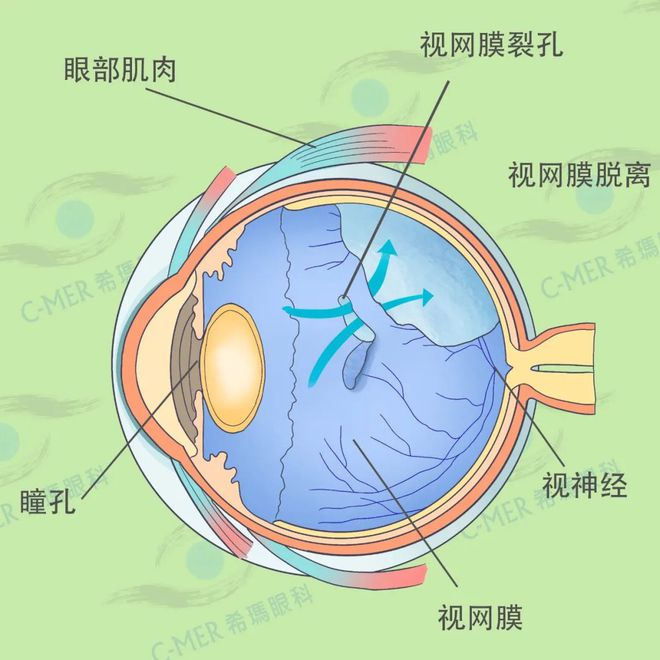 怎么用图艺图做动图_动悸是什么意思_悸动 动图