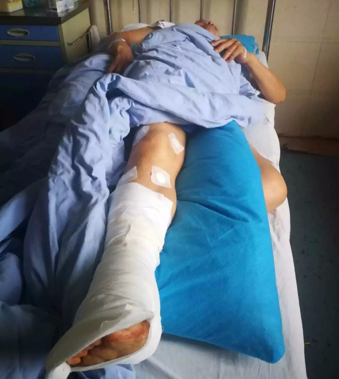 去医院挂号是什么流程_第一次去医院挂号_去医院挂号需要预约吗
