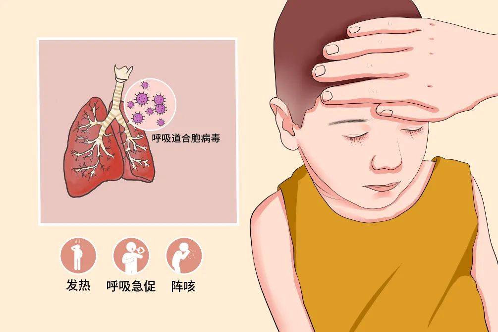 呼吸道合胞病毒感染_呼吸道合胞病毒感染会传染吗_呼吸道合胞体病毒感染
