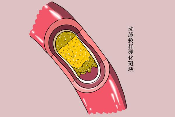 朝阳医院西区体检中心_朝阳医院西院体检中心_北京朝阳医院京西院区体检中心
