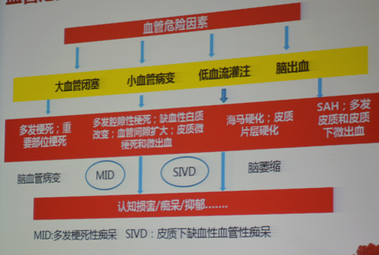 进展脑严重性卒中的症状_进展脑严重性卒中的原因_进展性脑卒中严重吗