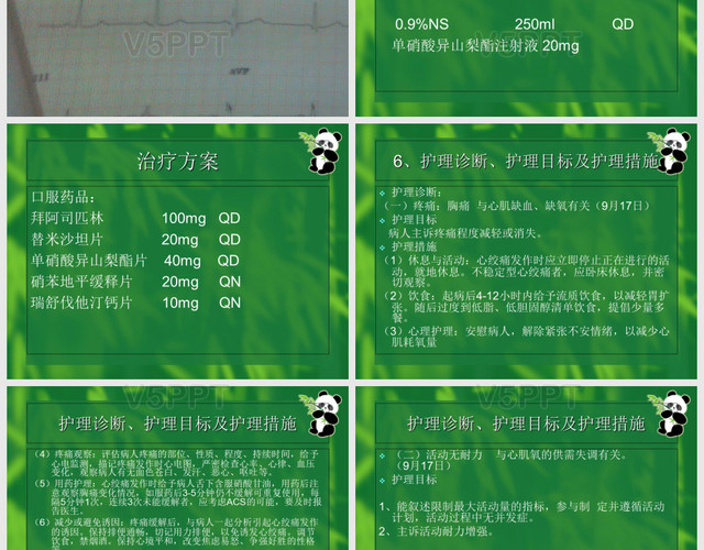 冠心病的护理记录_护理冠心病记录单怎么写_护理冠心病记录怎么写