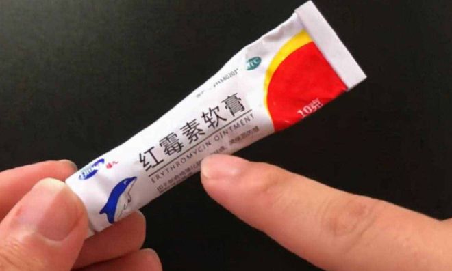 上大便时肛门无法开启_男友插肛门 大便失禁_大便失禁肛门疼