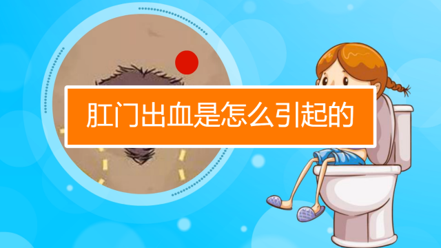 出血大便_大便出血是怎么回事吗_出血后大便什么病