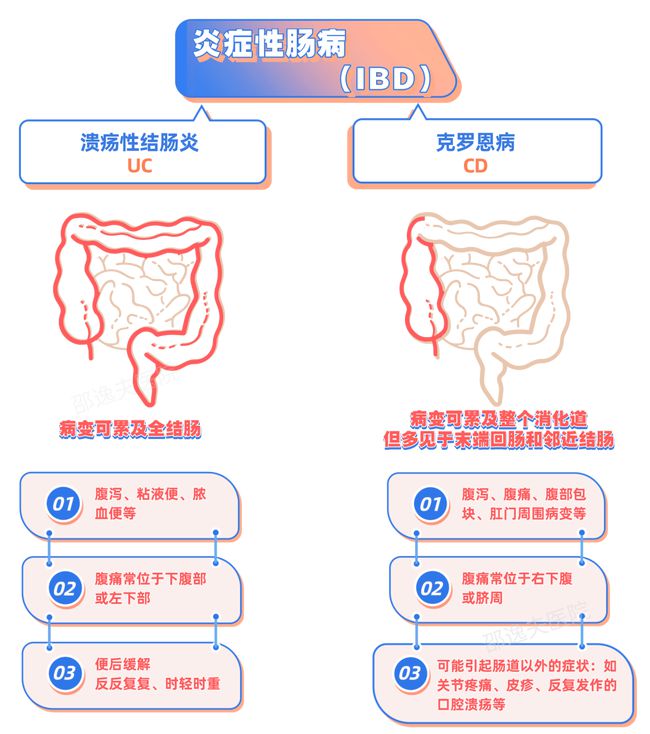 罗恩克病_克罗恩治疗方法_罗克恩病能治好吗
