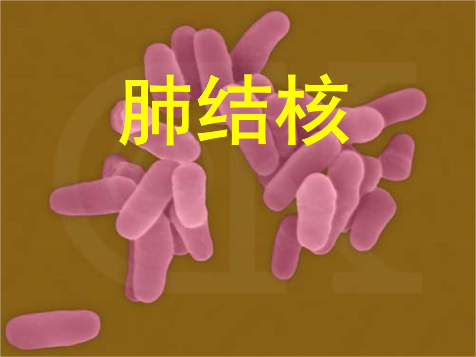 肺结核性继发复发会怎么样_肺结核性继发复发会传染吗_继发性肺结核会复发吗
