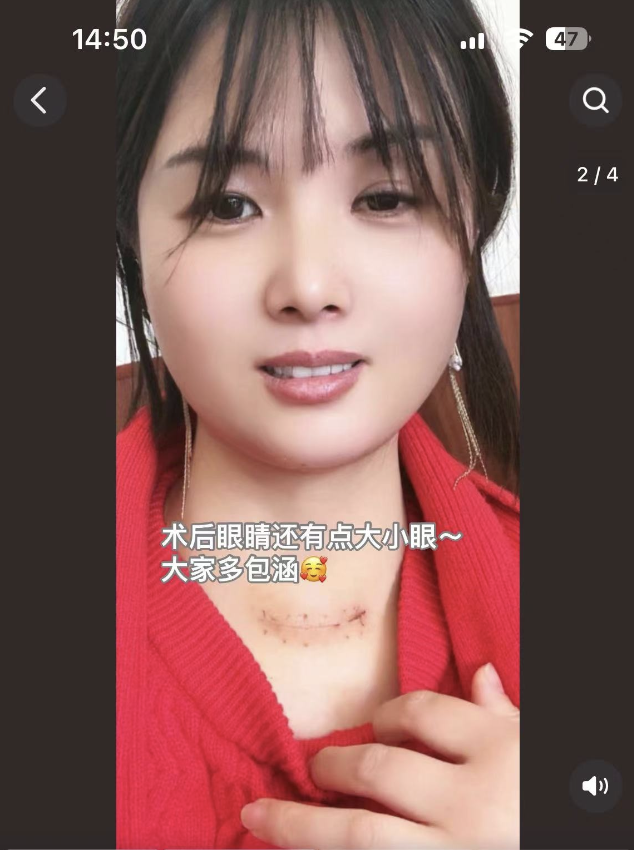 顶流网红自曝患癌！网友却说这不算癌？