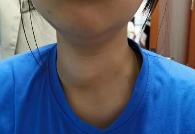 福建13岁女孩确诊癌症！医生紧急提醒......