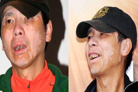 死于哮喘的明星_哪个明星哮喘发作死了_因哮喘去世的明星