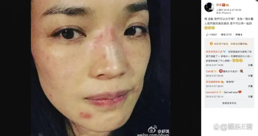 舒淇发文称被传染病毒！熬了5天结果……