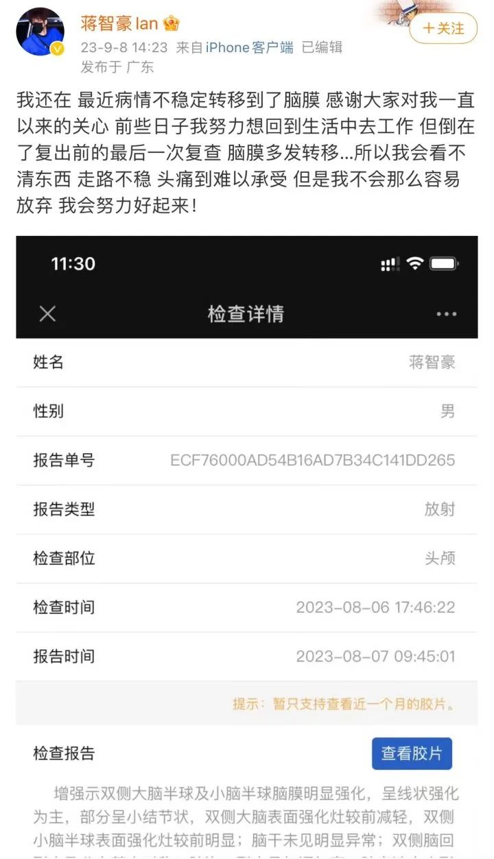 28岁艺人确诊肺癌晚期，最新发声：“我还是坚持过来了……”