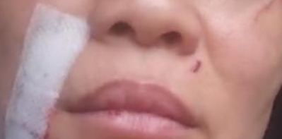 女子卖掉184平房产救狗，每月被咬10多次毫无怨言，值得吗？