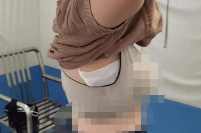 女子胸口藏16只蜥蜴入境被查