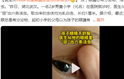 男童眼里捉出6条活虫！养猫养狗不做好这3件事，人宠最终都受苦