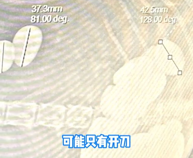 20多颗！成都一狗狗吐绿色胆汁，检查发现石头，竟因一个不良习惯