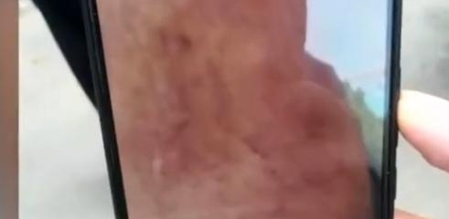 送货被客户的宠物狗咬伤拒绝，对小哥的索赔也被拒绝，听了顾客的