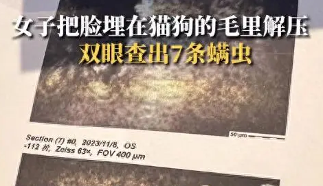 女子爱吸猫狗，把脸埋毛里致眼睛长7条螨虫