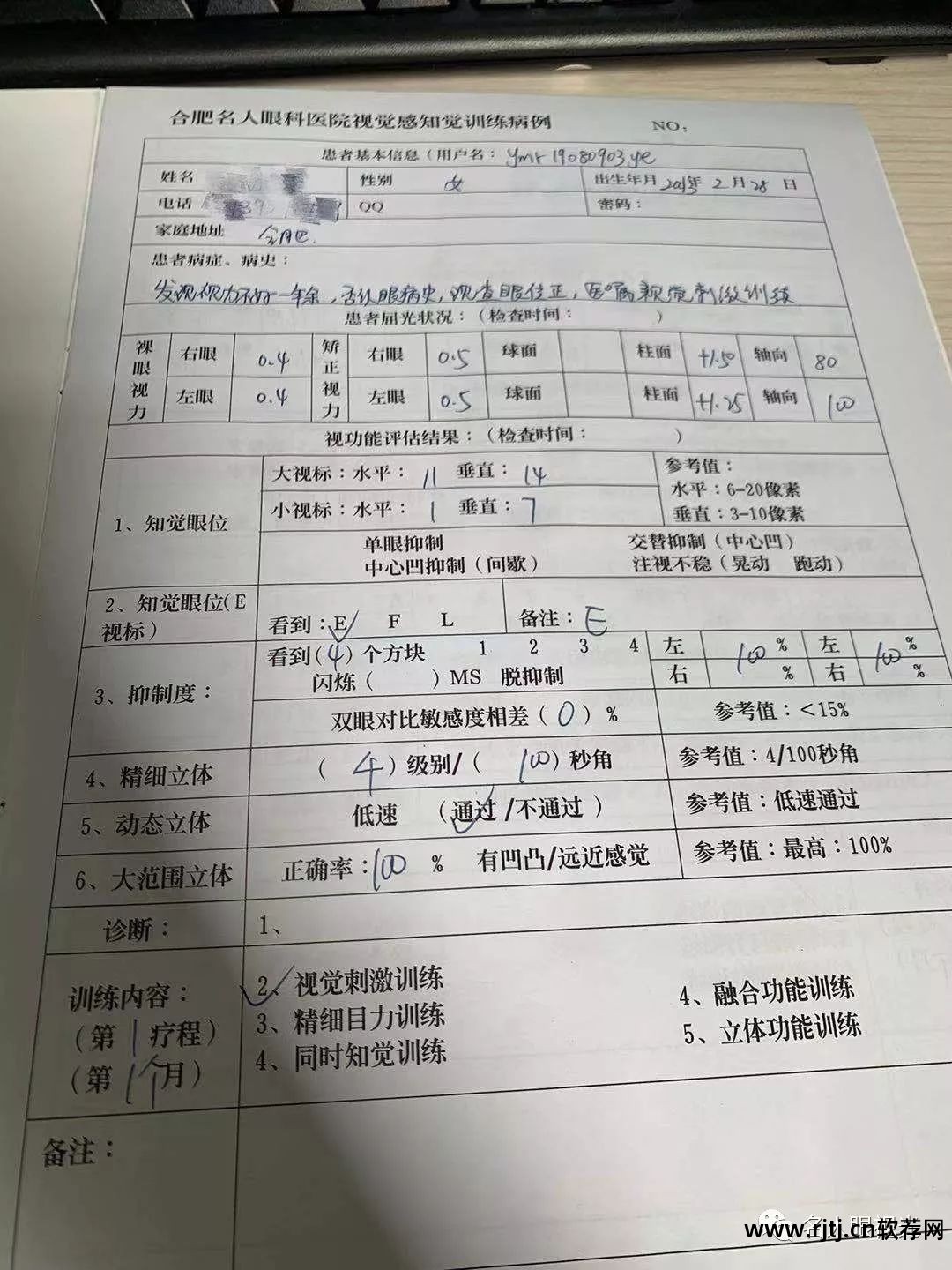 治疗弱视的软件_弱视治疗软件为何这么贵_弱视治疗软件作用大吗